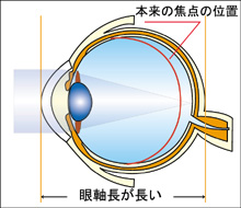 �����ߎ�